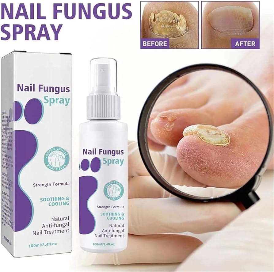 Nail Fungus Treatment Spray (Clinically Approved)