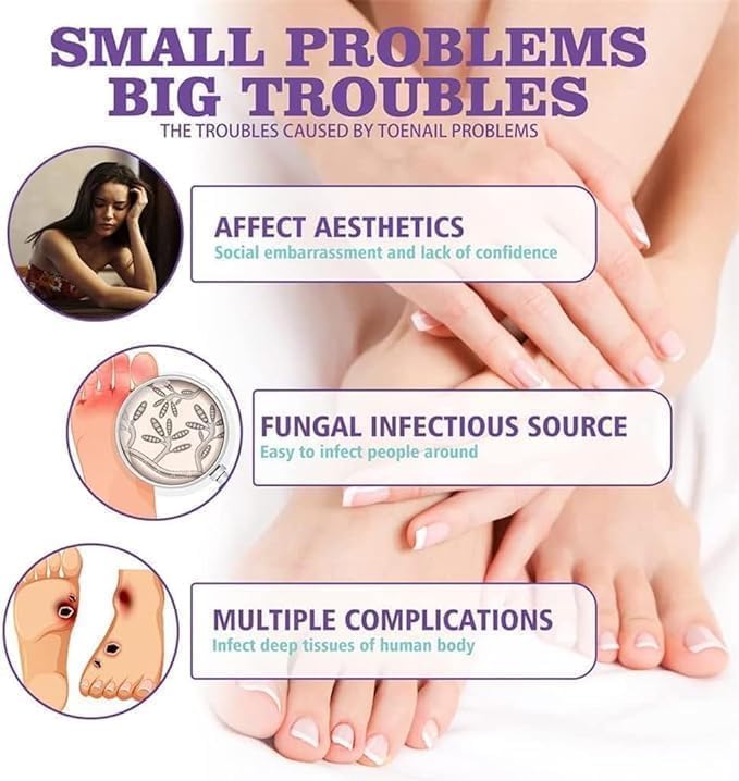 Nail Fungus Treatment Spray (Clinically Approved)