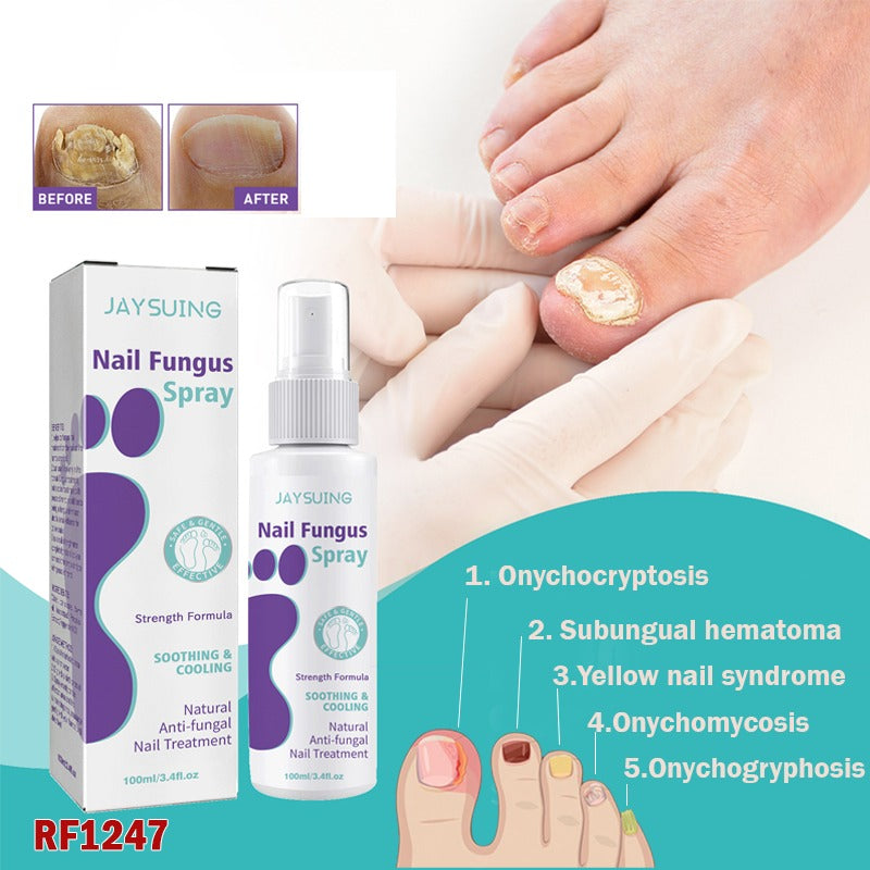 Nail Fungus Treatment Spray (Clinically Approved)