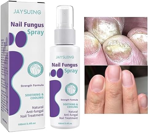 Nail Fungus Treatment Spray (Clinically Approved)