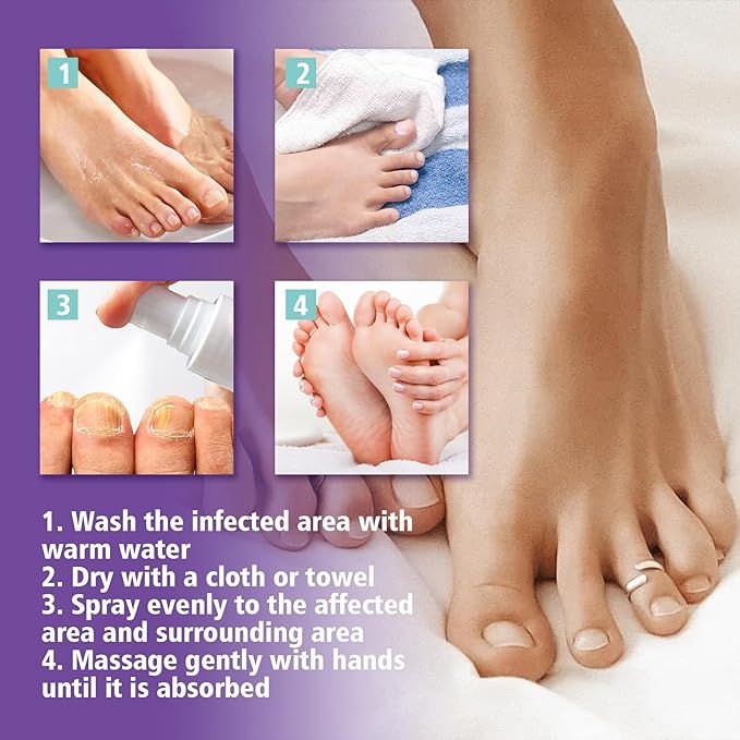 Nail Fungus Treatment Spray (Clinically Approved)