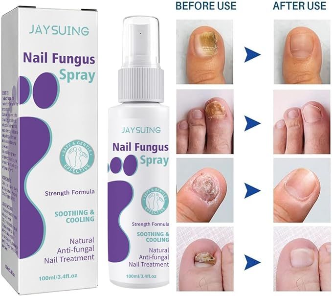 Nail Fungus Treatment Spray (Clinically Approved)
